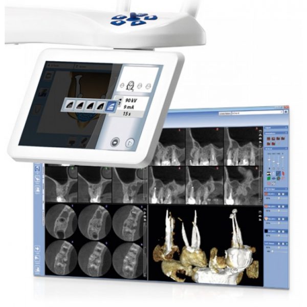 Planmeca-ProMax-3D-Mid-apparat-3D-vizualizacii-Planmeca-Finljandija-1